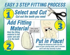 Instant Smile Temporary Tooth Kit – Pro-Series